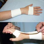 anclajes tira activa x