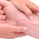 cicatriz diatermia tratamiento x