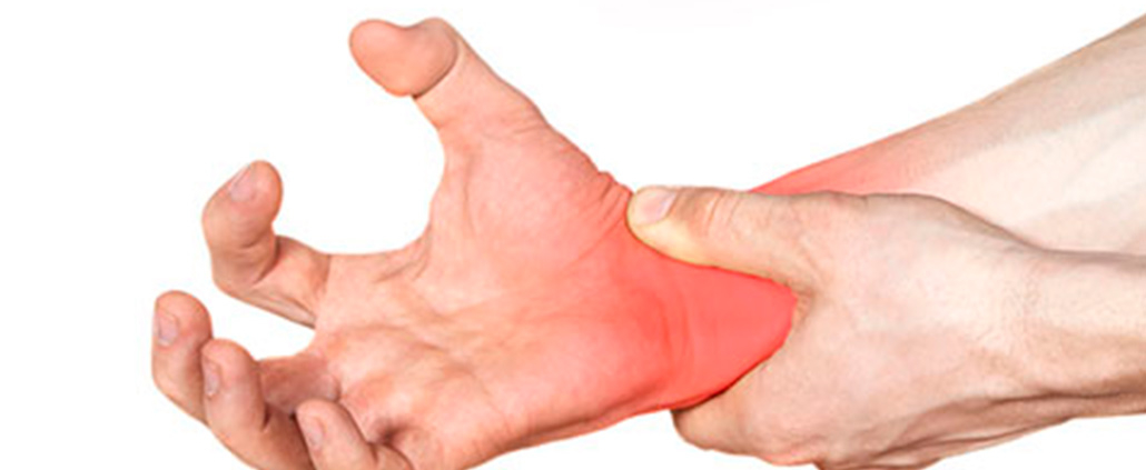 dolor regional complejo tipo I x