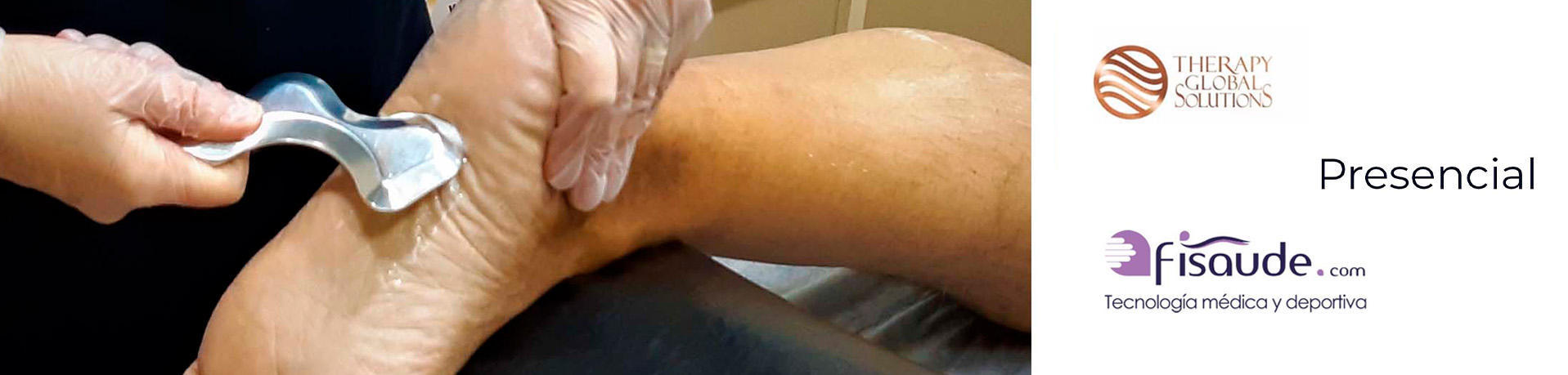 DIATERMIA RADIOFRECUENCIA EN EL TRATAMIENTO DEL SÍNDROME DE DOLOR MIOFASCIAL. IASTM – PRESENCIAL