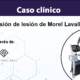 tratamiento-derrame-lesión-de-Morel-Lavallée-con-bomba-diamagnetica