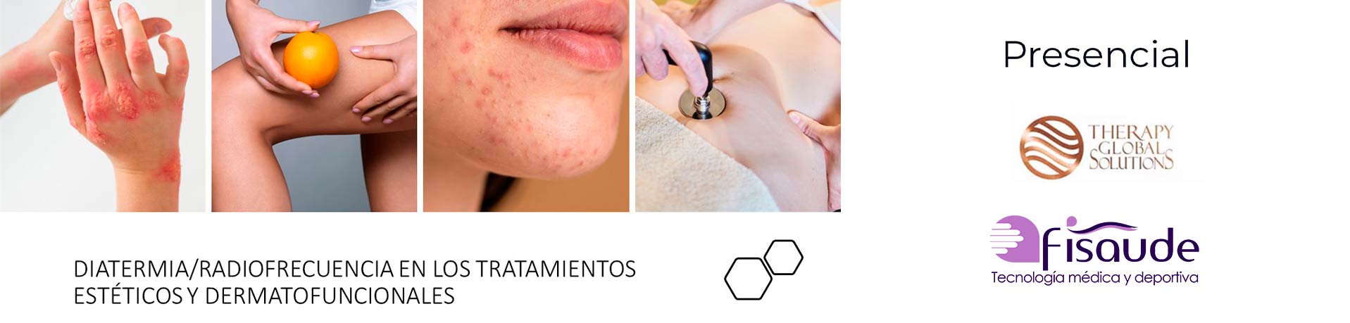 curso-diatermia-radiofrecuencia-10-junio-23