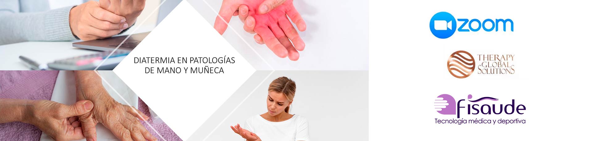 curso diatermia tratamiento de patologías mano y muñeca
