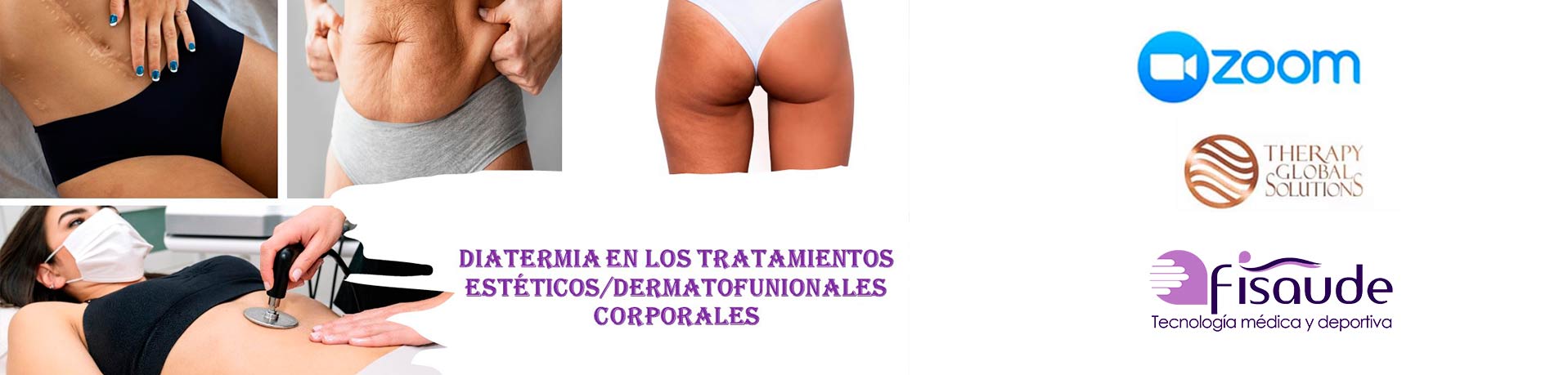 Radiofrecuencia - Dinamica Fisioterapia - DinamiBlog