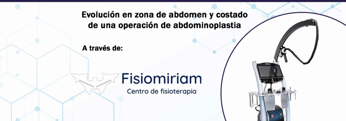 caso-clinico-bomba-diamagnetica-fisiomiriam-abdomen-y-costado-abdominoplastia-portada