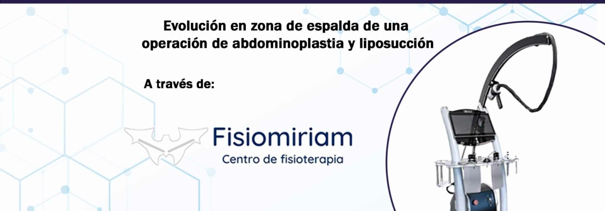 caso-clinico-bomba-diamagnetica-fisiomiriam-espalda-portada