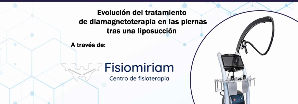caso-clinico-bomba-diamagnetica-fisiomiriam-piernas-liposuccion-portada
