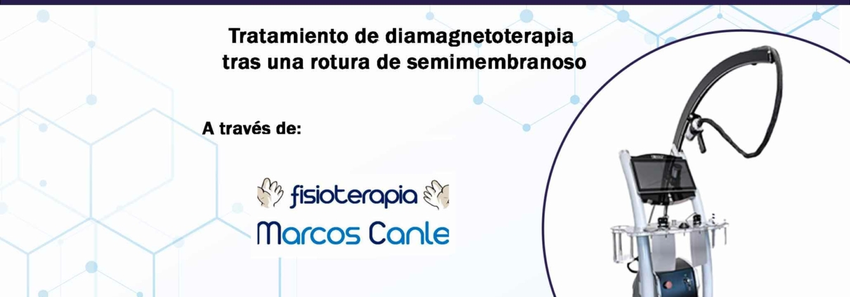 caso clinico bomba diamagnetica marcoscanle rotura semimembranoso portada x