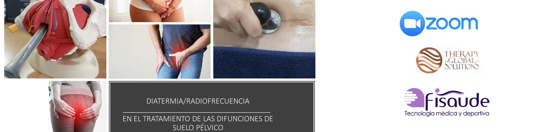 Diatermia---radiofrecuencia-en-el-tratamiento-de-las-disfunciones-de-suelo-pélvico---Vía-Zoom-30-septiembre