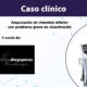 caso clinico bomba diamagnetica diegoperez portada x