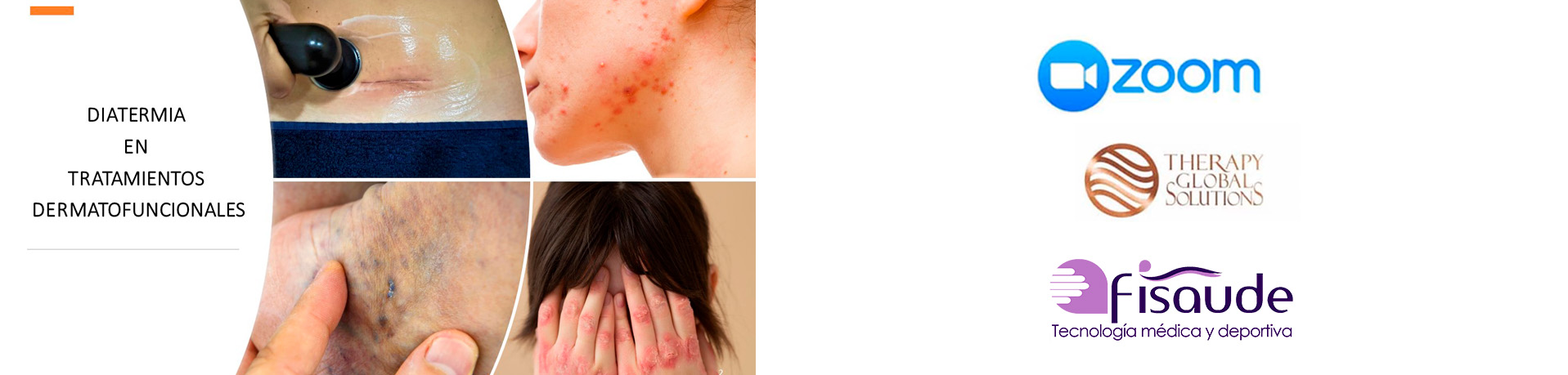 curos tratamientos dermatofuncionales 28 septiembre banner zoom