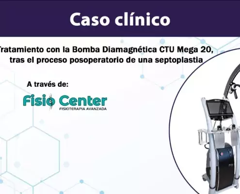 caso clinico bomba diamagnetica septoplastia portada x.jpg